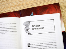 Уценка! ОСТЕОПОРОЗ. Эмиль Радулеску